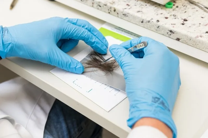 Exame toxicológico sendo realizado com amostra de cabelo, evidenciando a coleta para motoristas das categorias C, D e E