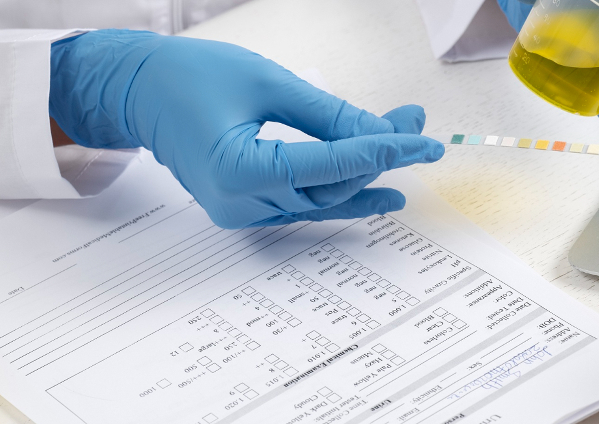 Mão com luva azul sobre formulário de exame toxicológico com tira de teste colorida e frasco amarelo em laboratório