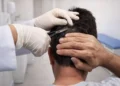 Profissional de saúde realiza coleta de cabelo de um homem para exame toxicológico exigido na primeira CNH.
