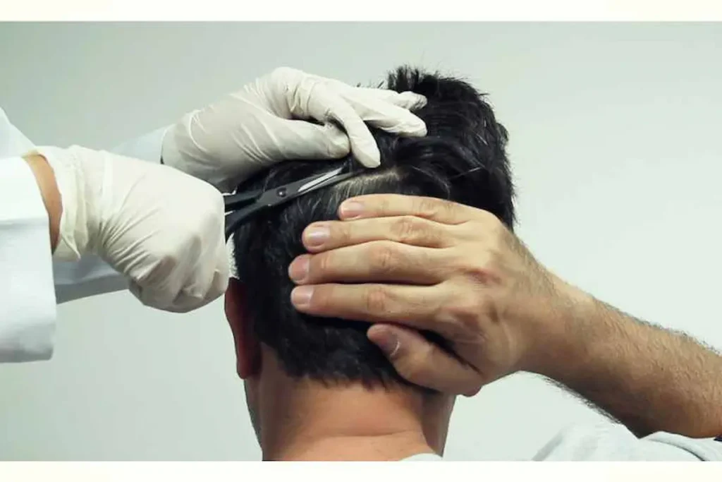 Profissional de jaleco e luvas coleta uma mecha de cabelo de um homem em laboratório.